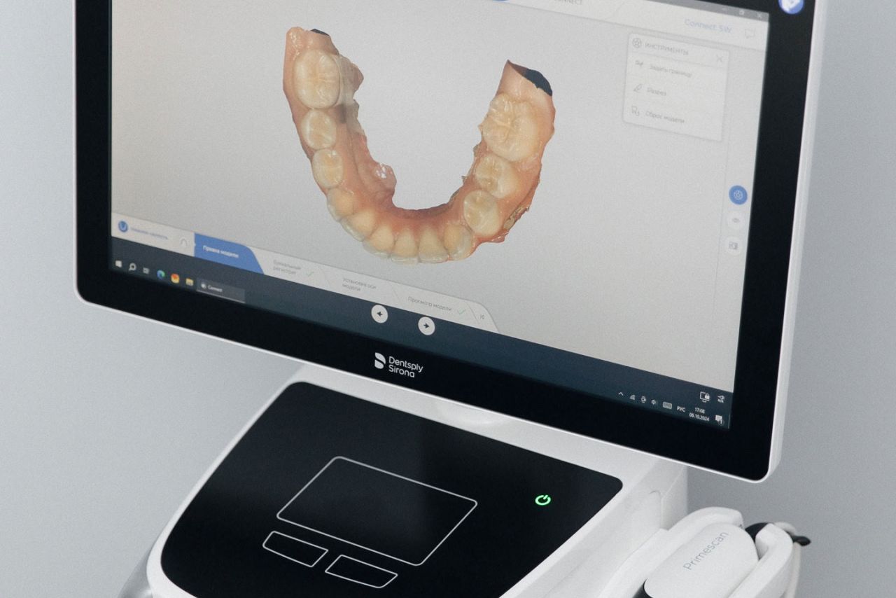 Стоматолог клиники Дентаграфия рассказывает, что показывает компьютерная томография